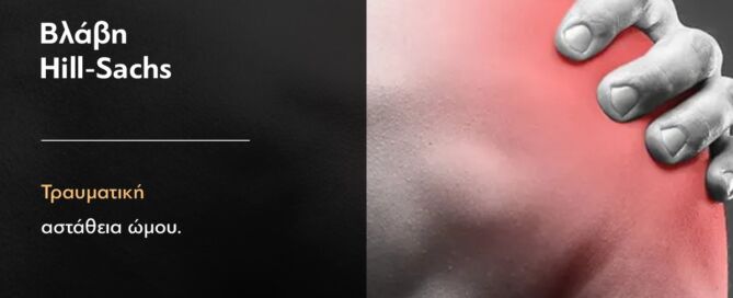 βλάβη hill sachs