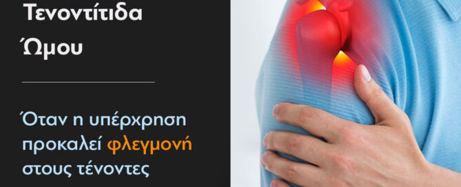 τενοντίτιδα ώμου αρθροσκόπηση