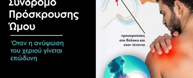σύνδρομο πρόσκρουσης ώμου