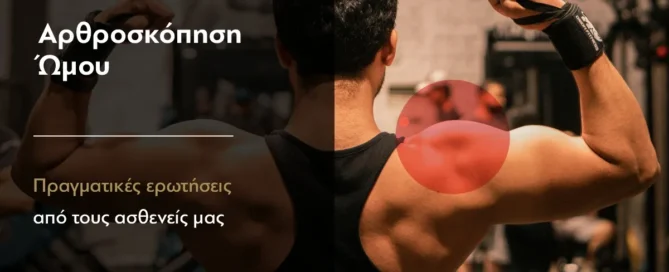 shoulder arthroscopy faq