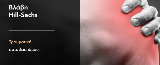 βλάβη hill sachs